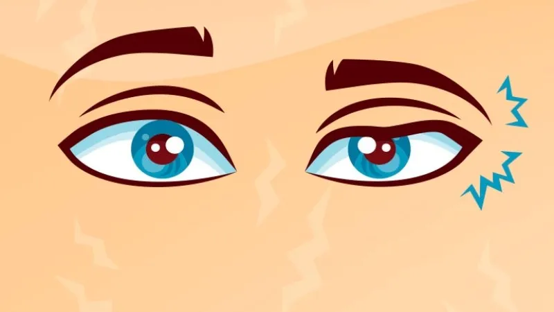 Cà phê giúp cải thiện vấn đề về co thắt mí mắt