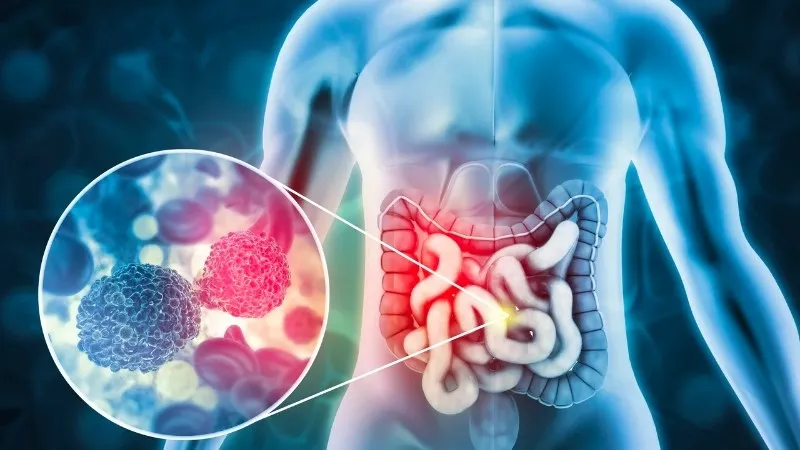 Tiêu chuẩn chọn mua cà phê hữu cơ chuyên dụng cho liệu pháp thải độc